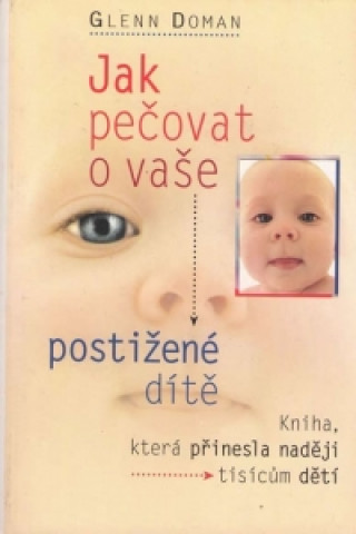 Jak pečovat o vaše postižené dítě