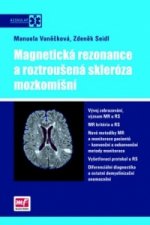 Magnetická rezonance a roztroušená skleróza mozkomíšní