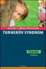 Turnerův syndrom
