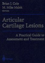 Articular Cartilage Lesions