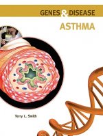 Asthma