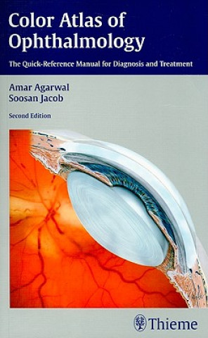 Color Atlas of Ophthalmology
