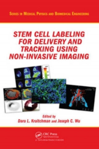Stem Cell Labeling for Delivery and Tracking Using Noninvasive Imaging
