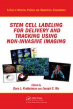 Stem Cell Labeling for Delivery and Tracking Using Noninvasive Imaging