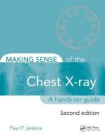 Making Sense of the Chest X-ray