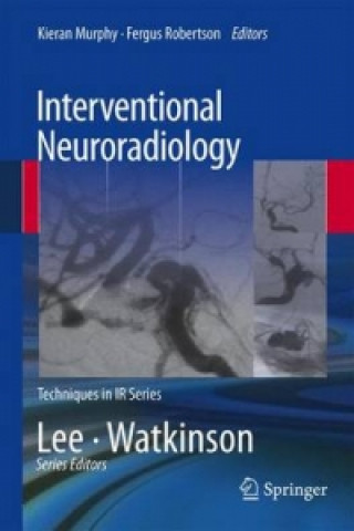 Interventional Neuroradiology