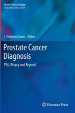 Prostate Cancer Diagnosis