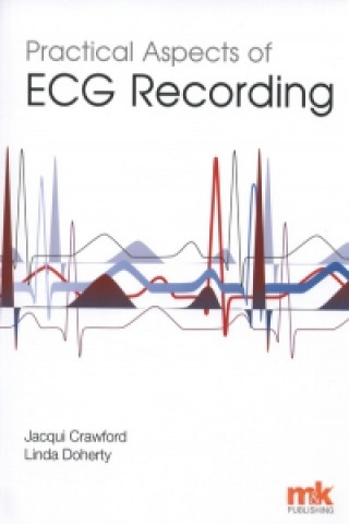 Practical Aspects of ECG Recording