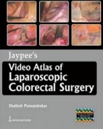 Jaypee's Video Atlas of  Laparoscopic Colorectal Surgery