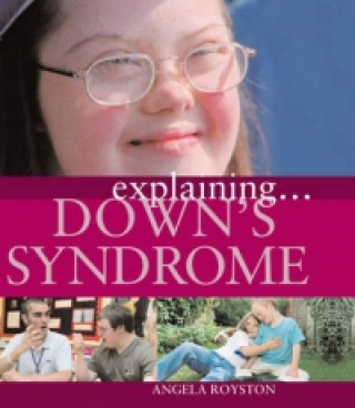 Explaining... Down's Syndrome