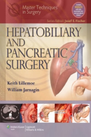 Master Techniques in Surgery: Hepatobiliary and Pancreatic Surgery