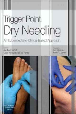 Trigger Point Dry Needling