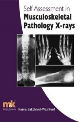 Self-assessment in Musculoskeletal Pathology X-rays