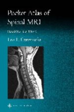 Pocket Atlas of Spinal MRI