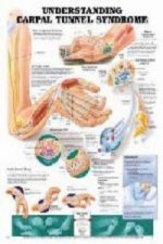 Understanding Carpal Tunnel Syndrome Anatomical Chart