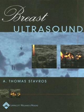 Breast Ultrasound