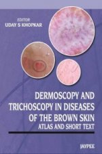 Dermoscopy and Trichoscopy in Diseases of the Brown Skin
