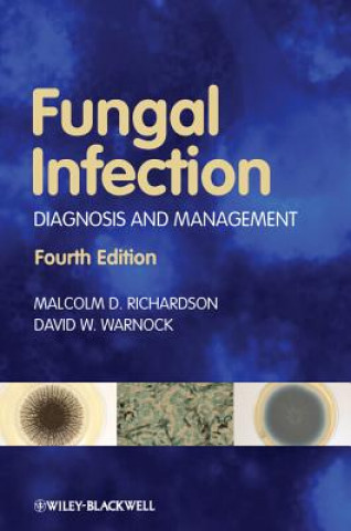 Fungal Infection - Diagnosis and Management 4e