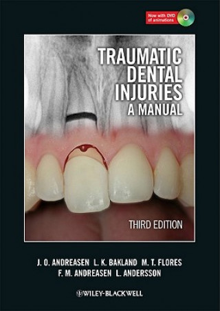 Traumatic Dental Injuries - A Manual 3e