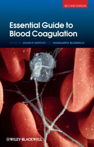 Essential Guide to Blood Coagulation 2e