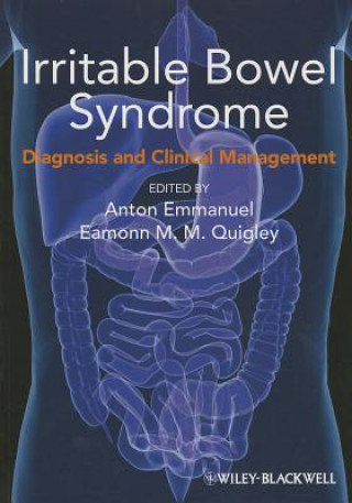 Irritable Bowel Syndrome - Diagnosis and Clinical Management