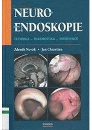 Neuroendoskopie