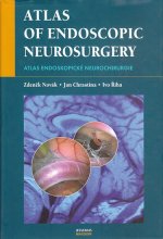 Atlas endoskopické neurochirurgie