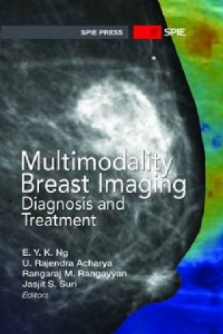 Multimodality Breast Imaging