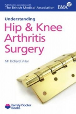 Understanding Hip & Knee Arthritis Surgery