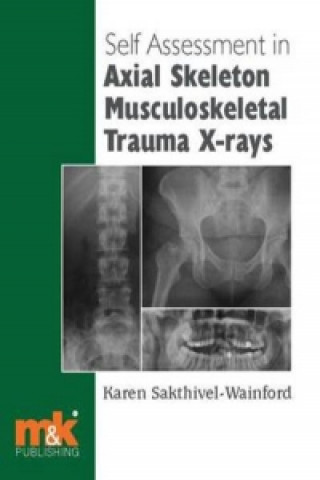 Self-assessment in Axial Skeleton Musculoskeletal Trauma X-rays