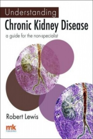 Understanding Chronic Kidney Disease: A Guide for the Non-specialist