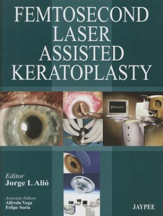 Femtosecond Laser Assisted Keratoplasty