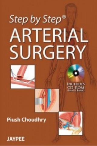 Step by Step: Arterial Surgery