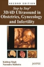 Step by Step: 3D/4D Ultrasound in Obstetrics, Gynecology and Infertility