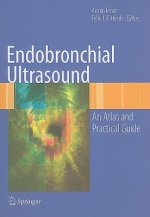 Endobronchial Ultrasound
