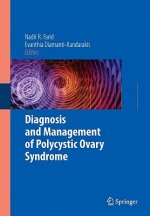 Diagnosis and Management of Polycystic Ovary Syndrome