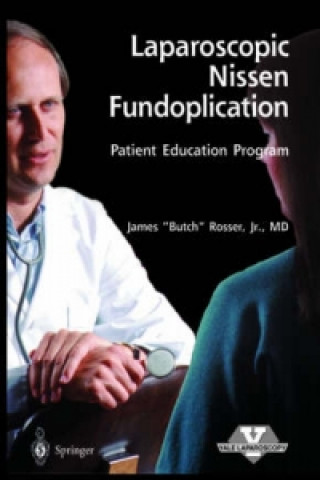 Laparoscopic Nissen Fundoplication - Patient Education Program, 1 CD-ROM
