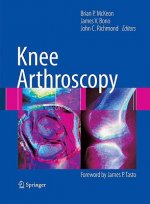 Knee Arthroscopy