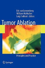 Tumor Ablation