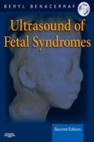 Ultrasound of Fetal Syndromes, w. DVD