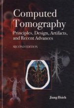 Computed Tomography Principles, Design, Artifacts,  and Recent Advances
