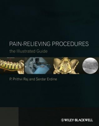 Pain-Relieving Procedures - The Illustrated Guide