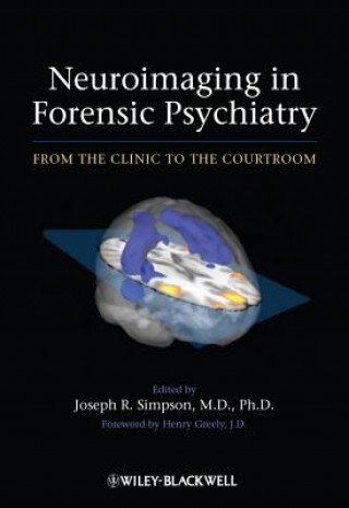 Neuroimaging in Forensic Psychiatry - From the Clinic to the Courtroom