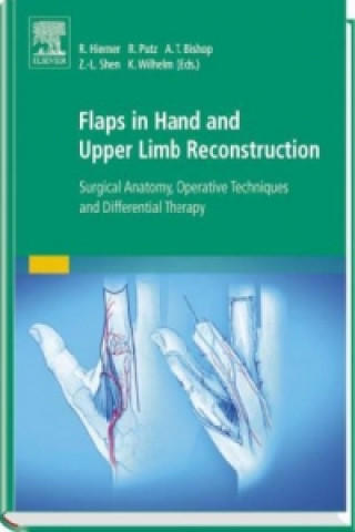 Flaps in Hand and Upper Limb Reconstruction