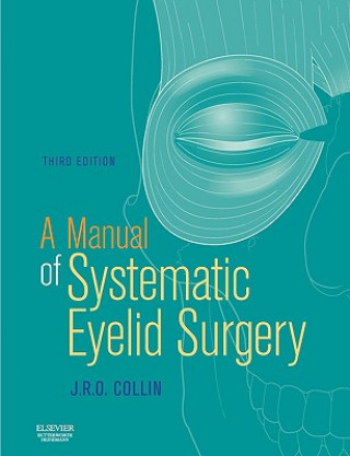 Manual of Systematic Eyelid Surgery