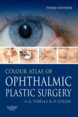 Colour Atlas of Ophthalmic Plastic Surgery, w. DVD-ROM