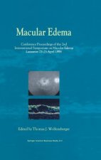Macular Edema