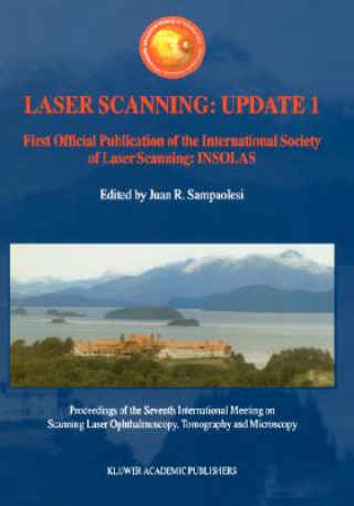 Laser Scanning: Update 1