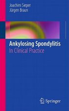 Ankylosing Spondylitis