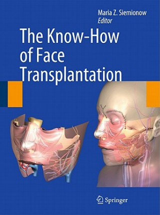 Know-How of Face Transplantation